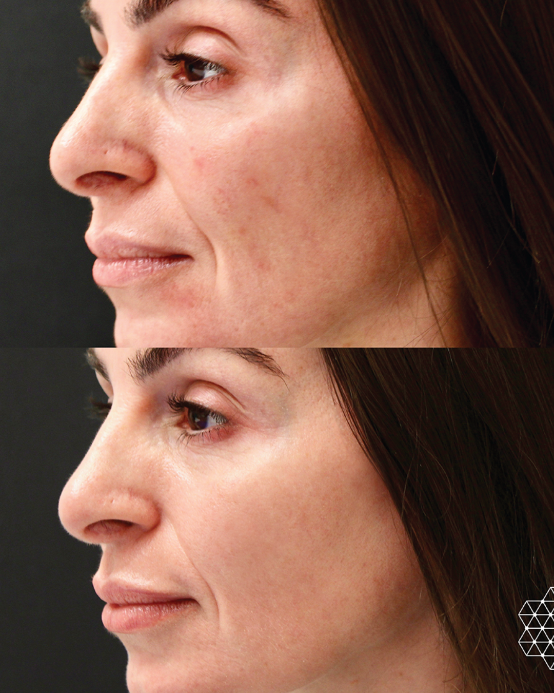 The Sun Repair Package