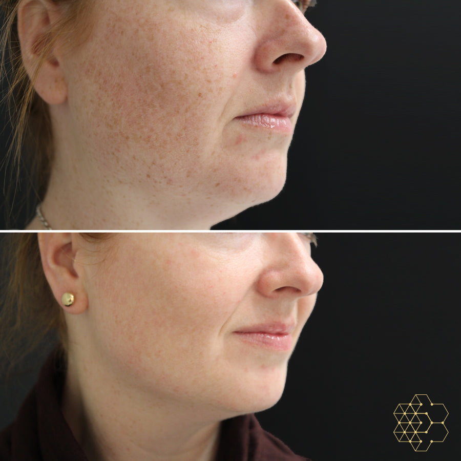 The Sun Repair Package