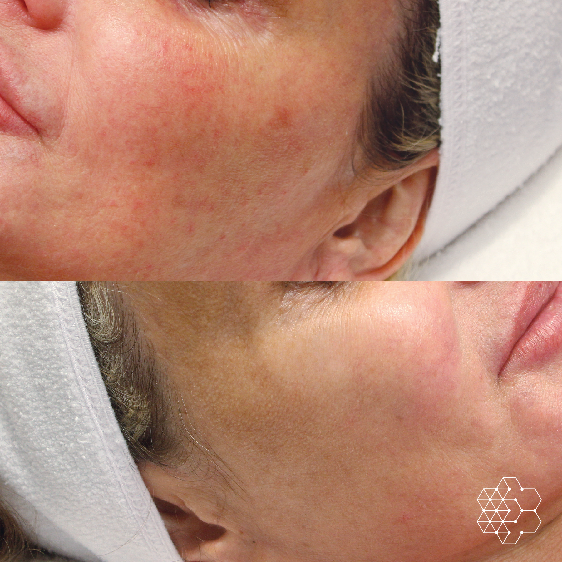 The Signature Glow Duo