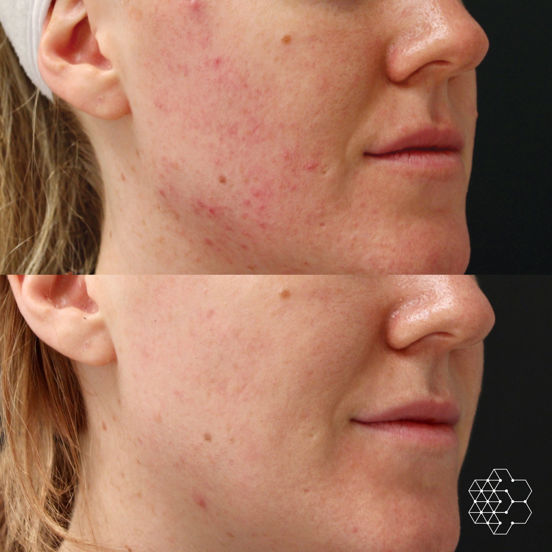 The Signature Glow Duo