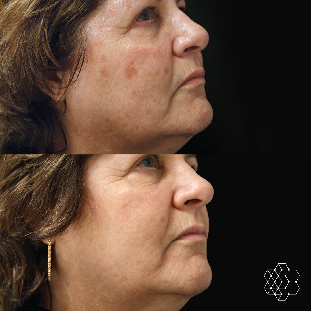 The Sun Repair Package
