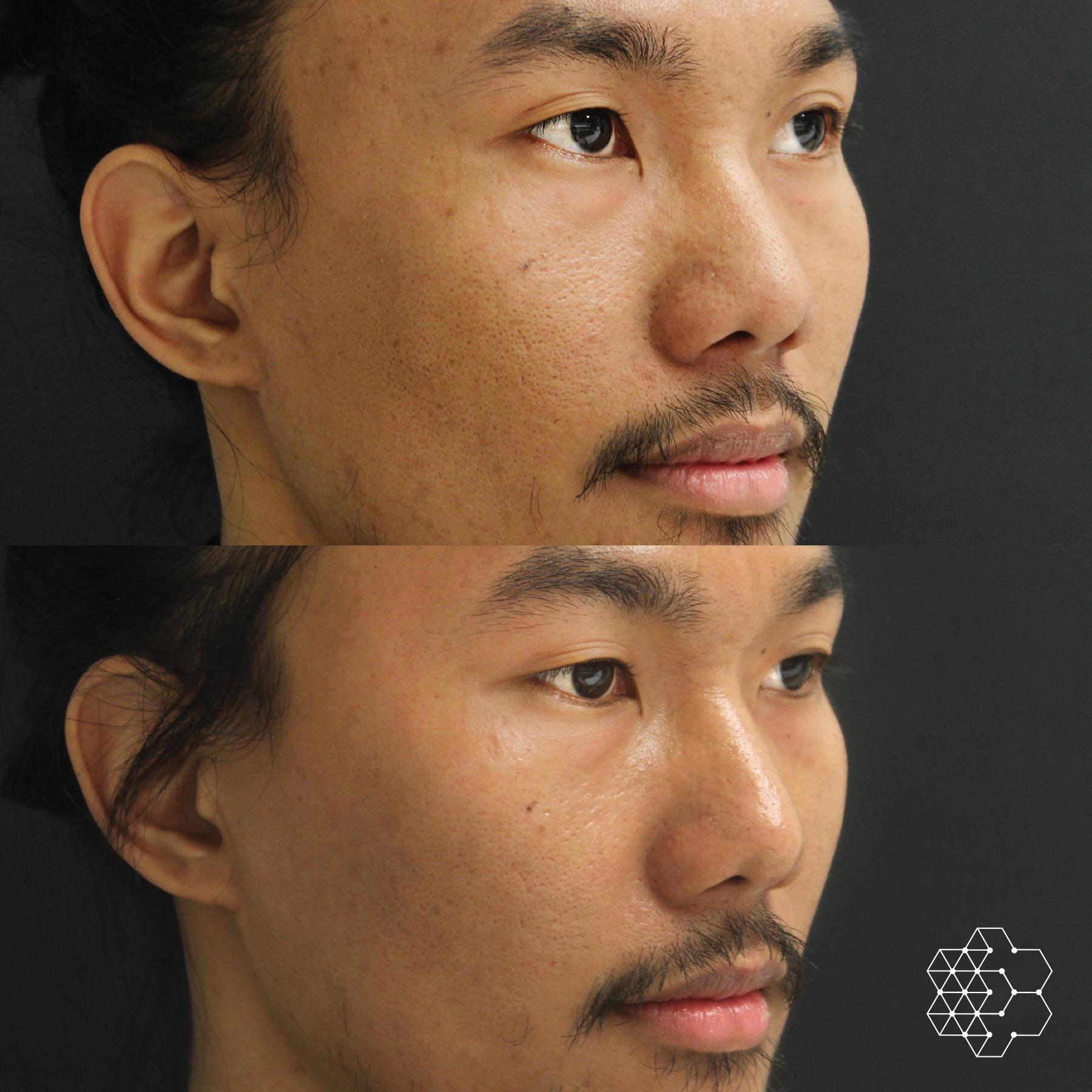 The Signature Glow Duo